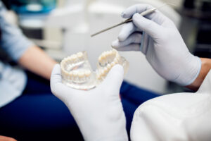 Clear Aligners for Teeth