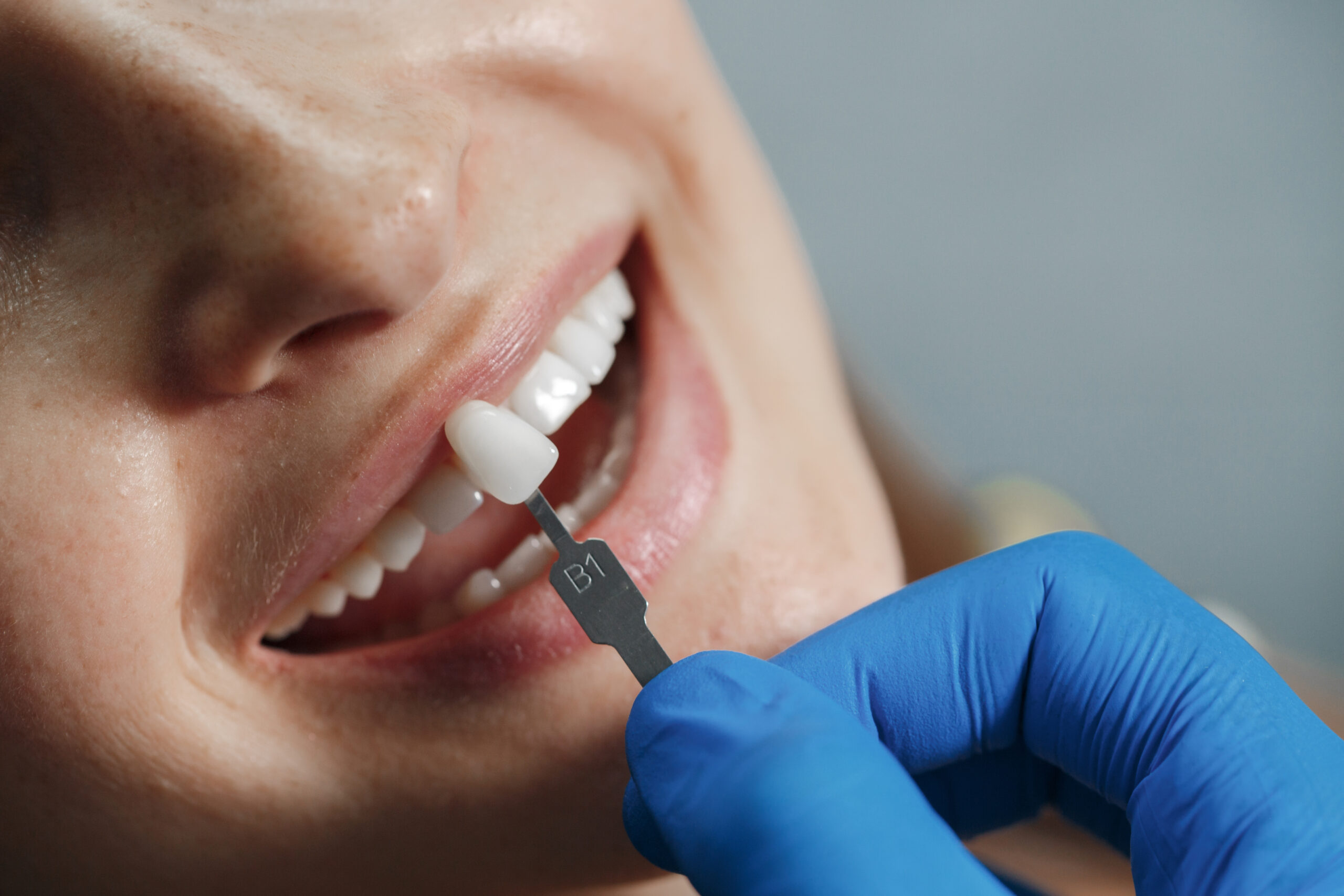ventura dental implants