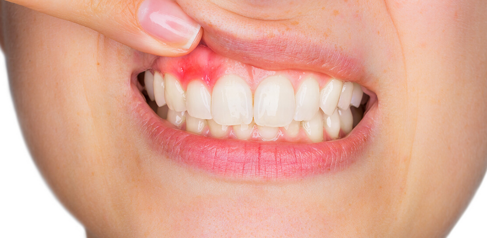 dentist for gum disease