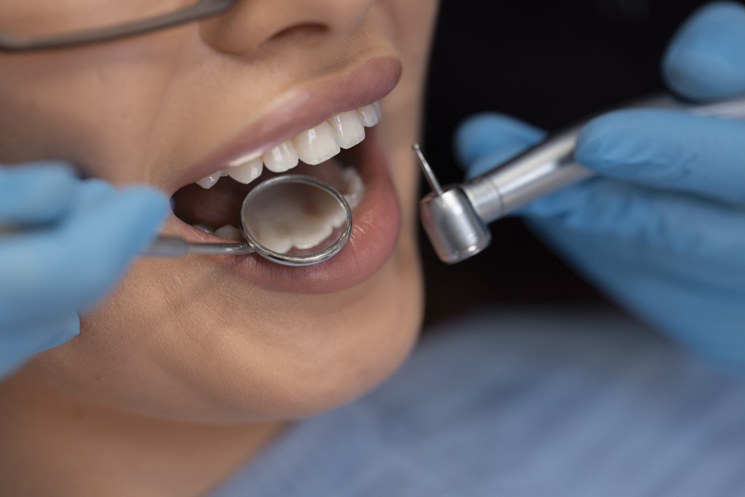 close up dentist using instruments