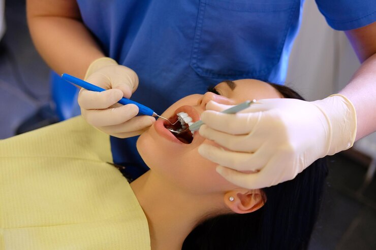Dental fillings in Ventura