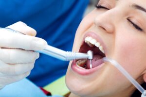 dental fillings in Ventura