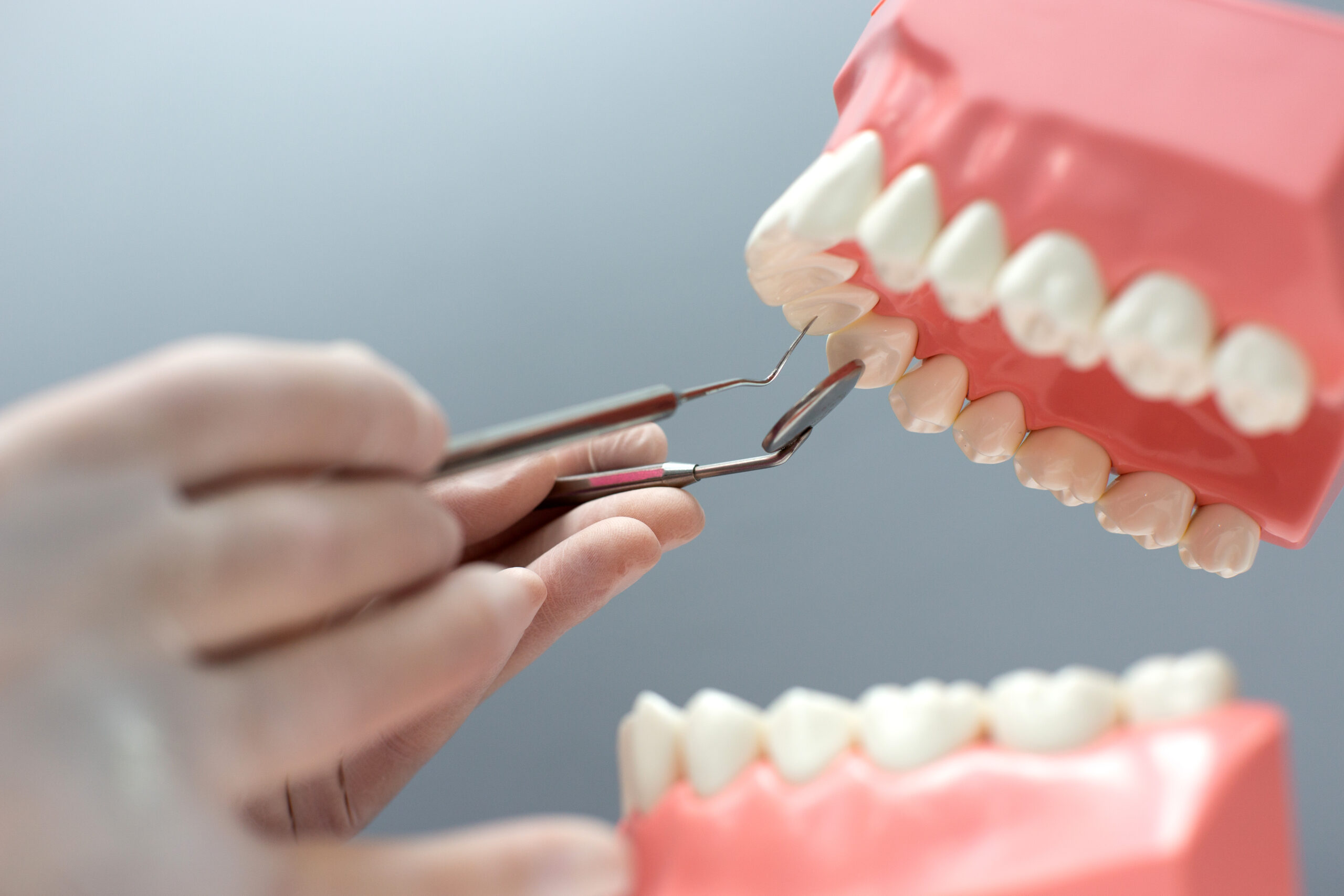 Dental Bridges